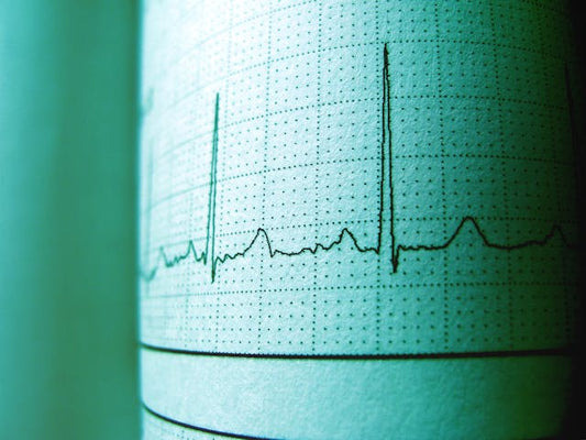 HRR: How to Boost Your Heart Rate Recovery for a Longer Life